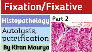 Fixative Fixation histopathology methanol ethanol Autolysis by Kiran maurya [upl. by Dahs462]