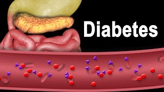 Diabetes Type 1 and Type 2 Animation [upl. by Audsley342]