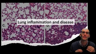 Lung inflammation and disease [upl. by Cristobal86]