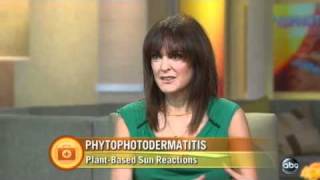 ABC News with Dr Day  Phytophotodermatitis [upl. by Lewie]