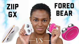 FOREO Bear Review  FOREO Bear vs Ziip GX [upl. by Derfliw]