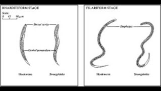 Differentiating Hookworm from Threadworm [upl. by Ozzy]