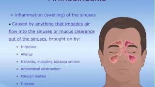 What are the Sinuses [upl. by Katha]