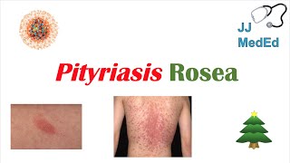 Introduction to Pityriasis Rosea  Possible Causes Symptoms and Treatment [upl. by Rida]