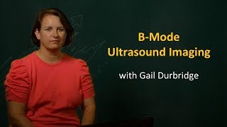 UQx Bioimg101x 425 BMode Ultrasound [upl. by Acinoj]