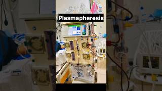 Plasmapheresis With Advanced Dialysis Machine nephrology kidneyhealth kidneydisease ytshorts [upl. by Carrick]