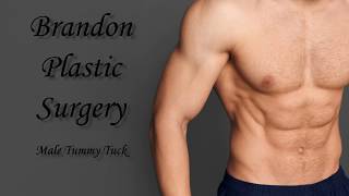 Male Abdominoplasty Surgery Results [upl. by Eintirb]