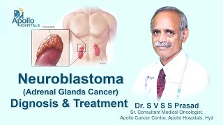 Neuroblastoma  Diagnosis amp Treatment  Dr SVSS Prasad Medical Oncologist  Apollo Hospital [upl. by Sathrum]