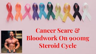 Cancer Scare and Bloodwork On 900mg Steroid Cycle [upl. by Abbot]