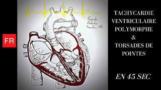 Arythmies animation cardiaque et ECG  Tachycardie Ventriculaire Polymorphe Shorts [upl. by Cohla]