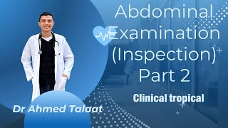 Abdominal examination  inspection part 2Clinical tropicalDr Ahmed Talaat [upl. by Yna]