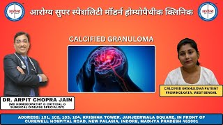 Calcified Granuloma Patient Treated By Dr Arpit Chopra Jain [upl. by Gabbert]