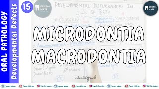 Microdontia  Macrodontia  Developmental disturbances in size of teeth  Dr Paridhi Agrawal [upl. by Lledraw]