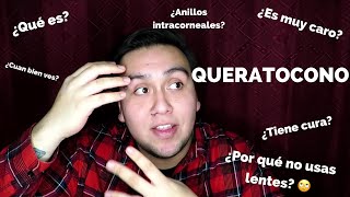 ¿Que es el Queratocono Mi experiencia con anillos intracorneales  storytime 1  IanWanderluster [upl. by Grand]