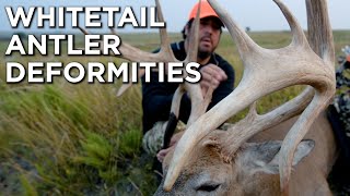 Whitetail Deer Antler Deformities And How They Develop  Drop Tines Kickers Acorn Points [upl. by Torr520]