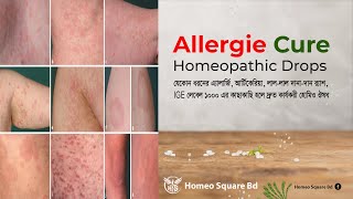 Allergies  Rhinitis  এ্যালার্জির হোমিও ঔষধ  IgE eosinophils Homeopathy Medicine  যশোর [upl. by Goulden770]