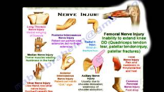 Nerve Injuries Summary Thank You Card  Everything You Need To Know  Dr Nabil Ebraheim [upl. by Nairb]