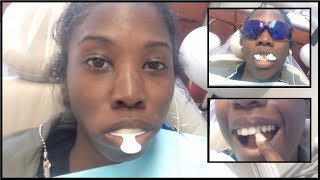 NEW TEETH  My Dental Bridge Journey Part 1 [upl. by Doolittle]