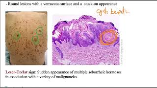 USMLE ACE Video 192 Skin Disorders Overview [upl. by Pillihp371]