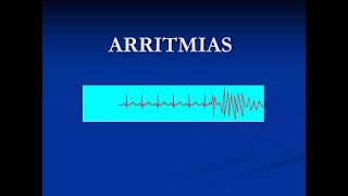 13 MI ECG Anormal Arritmias SV  FA  Síndromes de Preexcitación Dr Miguel 230621 [upl. by Cudlip44]