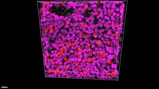 CX3CR1 Is Expressed in Differentiated Human Ciliated Airway Cells and CoLocalizes [upl. by Gilead]