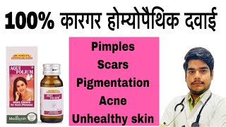 Best homeopathic medicine for acnepimplesscarsand skin whitening  Berberis aquifolium drop [upl. by Andy105]