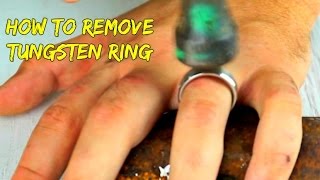 Emergency Removal of a Tungsten Ring [upl. by Parks]