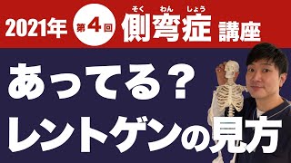 2021年【第４回】側弯症講座「本当にあってる？側弯症の正しいレントゲンの見方」 [upl. by Elene363]