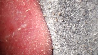 Pore Strips removal close up Blackheads removal [upl. by Ahseel816]