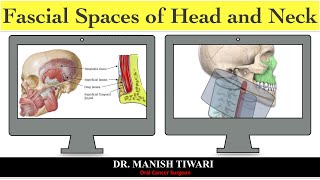 Odontogenic space infection part  1 fascial spaces of head and neck [upl. by Sharline]