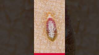 What do bed bug bites look like while still feeding  Orkin Canada [upl. by Peterson791]