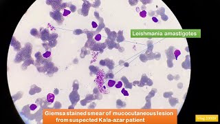 Leishmania amastigotes Microscopy [upl. by Bergess]