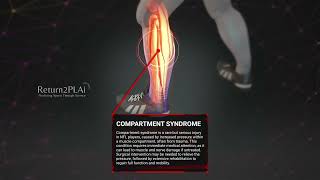 Compartment Syndrome [upl. by Raddy]