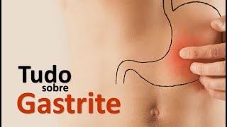 TUDO SOBRE GASTRITE  SINAIS SINTOMAS E TRATAMENTO  Dr Marcelo Lima [upl. by Binnings]