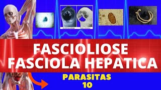 FASCIOLIOSE  FASCIOLA HEPATICA  PARASITOLOGIA INFECTOLOGIA [upl. by Eima]