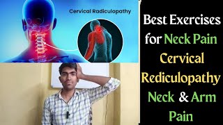 The Best Exercises for Cervical Radiculopathy [upl. by Apilef]