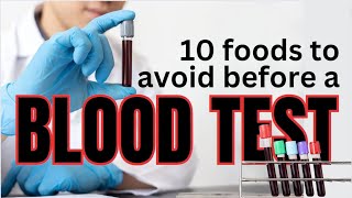 quot10 Foods to Avoid Before a Blood Test Essential PreTest Tips for Accurate Resultsquot [upl. by Ichabod]