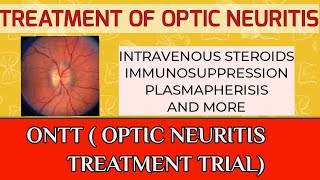 Treatment of optic neuritis and multiple sclerosis [upl. by Effie]