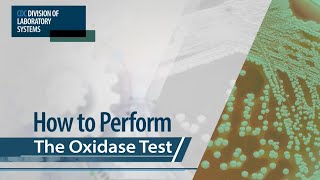 How to Perform the Oxidase Test [upl. by Eduino737]