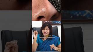 Shocking secret about the Nose 😲  Dr Radha [upl. by Enirhtak510]