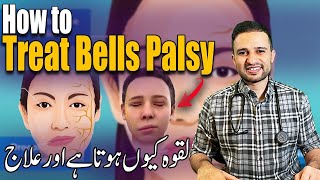 Laqwa ka Ilaj  How to Treat Bells Palsy [upl. by Arraes]