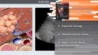 Diagnostic Ultrasound Abdomen and Pelvis [upl. by Rola]