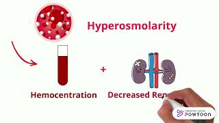 8 Hemoconcentration [upl. by Seline]