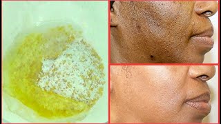 NATURAL EXFOLIATING FACIAL SCRUB FOR CLEARING BLACKHEADS DARK SPOTS DULL DRY SKIN GET CLEAR SKIN [upl. by Pauiie120]