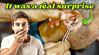 It was a Real Surprise earwax earwaxremoval [upl. by Nylehtak]