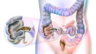 Large intestine  Caecum amp Appendix Part 2 [upl. by Etteniotnna341]