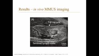 In Vivo Magnetomotive Ultrasound Imaging Of Rat Lymph Nodes – A Pilot Study [upl. by Ekram900]