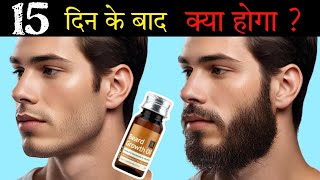 Ustraa Beard Growth Oil After 15 Days Review  Best Beard Oil For Patchy Beard in India 2024 [upl. by Meedan]