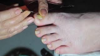 Transforming Blue to Red Winter Pedicure Tutorial at Home [upl. by Good]