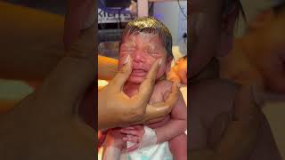 Nose massage babyreview newbornbaby morevews baby babyborn cute newborn love [upl. by Nerrot]